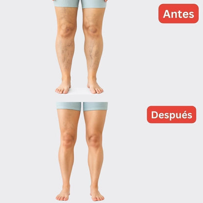 Pack 2+2 GRATIS Medias de Descanso – Alivio Diario para Varices y Piernas Cansadas