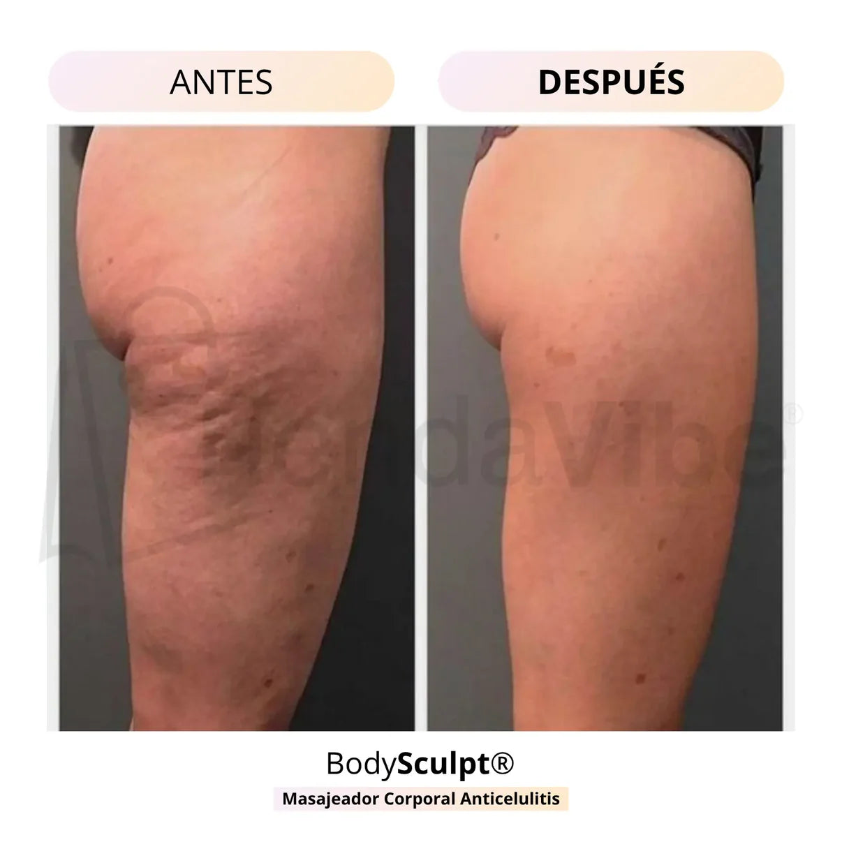 Masajeador Anticelulitis + Levantador de Glúteos