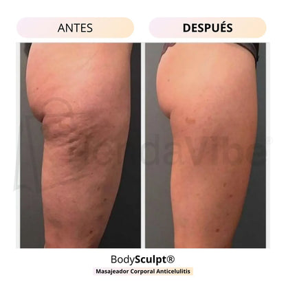 Masajeador Anticelulitis + Levantador de Glúteos